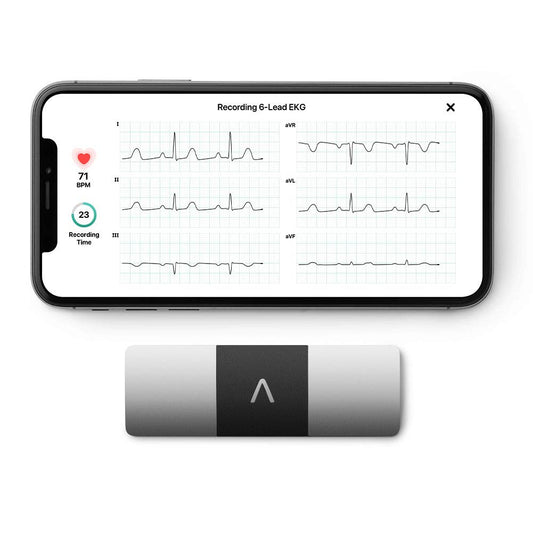 AliveCor KardiaMobile Wireless 6-Lead Detects AFib or Normal Heart Rhythm EKG Monitor